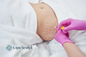 Are The Results From Aqualyx Permanent? 1 Do you want to know how long Aqualyx Anstey results last?