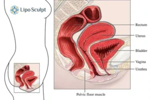 Treatment For A Leaky Bladder 2 How EM Chair treatment Anstey can help Leaky bladder issues. Read more now!