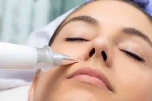 Best Actinic Keratoses Removal 3 Actinic keratoses Anstey solutions - book in today!