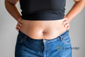 Bidding Farewell to Muffin Tops with Aqualyx Fat Injections 2 Do you wish you could reduce your muffin top Anstey With Aqualy fat dissolving injections you can!
